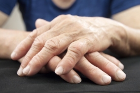 arthritis milyen betegség