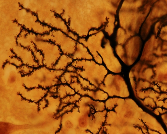 Dendritic tree of a Purkinje neuron stained with the silver Golgi method. The dendrite surface is full of small dendritic spines (Forrás: 123rf.com)