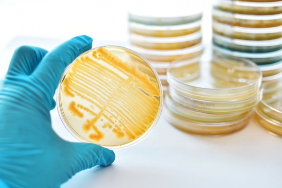 Colonies of bacteria in petri dish (Forrás: 123rf-archív)